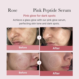 Sérum Éclat <span class=keywords><strong>Rose</strong></span> avec Peptide Niacinamide Hydratant Raffermissant Teint Inégal Sérum Blanchissant <span class=keywords><strong>Taches</strong></span> Noires Ciblées - Product Image 2