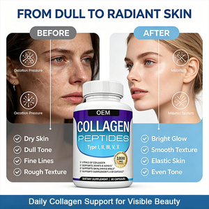 Cápsulas AURA 90, Péptidos de Colágeno Hidrolizado Tipo I, II, III, V y X con Vitamina C y Ácido Hialurónico para una Piel Radiante - Product Image 4