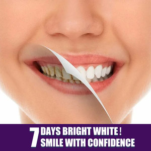 2026 Más Vendido: Herramienta Portátil para Blanquear Dientes Amarillentos <span class=keywords><strong>EELHOE</strong></span>, <span class=keywords><strong>Corrector</strong></span> Morado, Lápiz Blanqueador Dental - Product Image 5