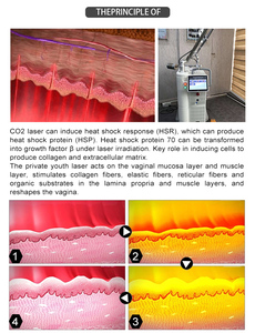 Máquina de Láser Fraccional de CO2 para Tratamiento del Acné, Eliminación de Arrugas y Suavizado de Cicatrices, Máquina de Grabado Láser de CO2 para Rejuvenecimiento de la Piel - Product Image 3