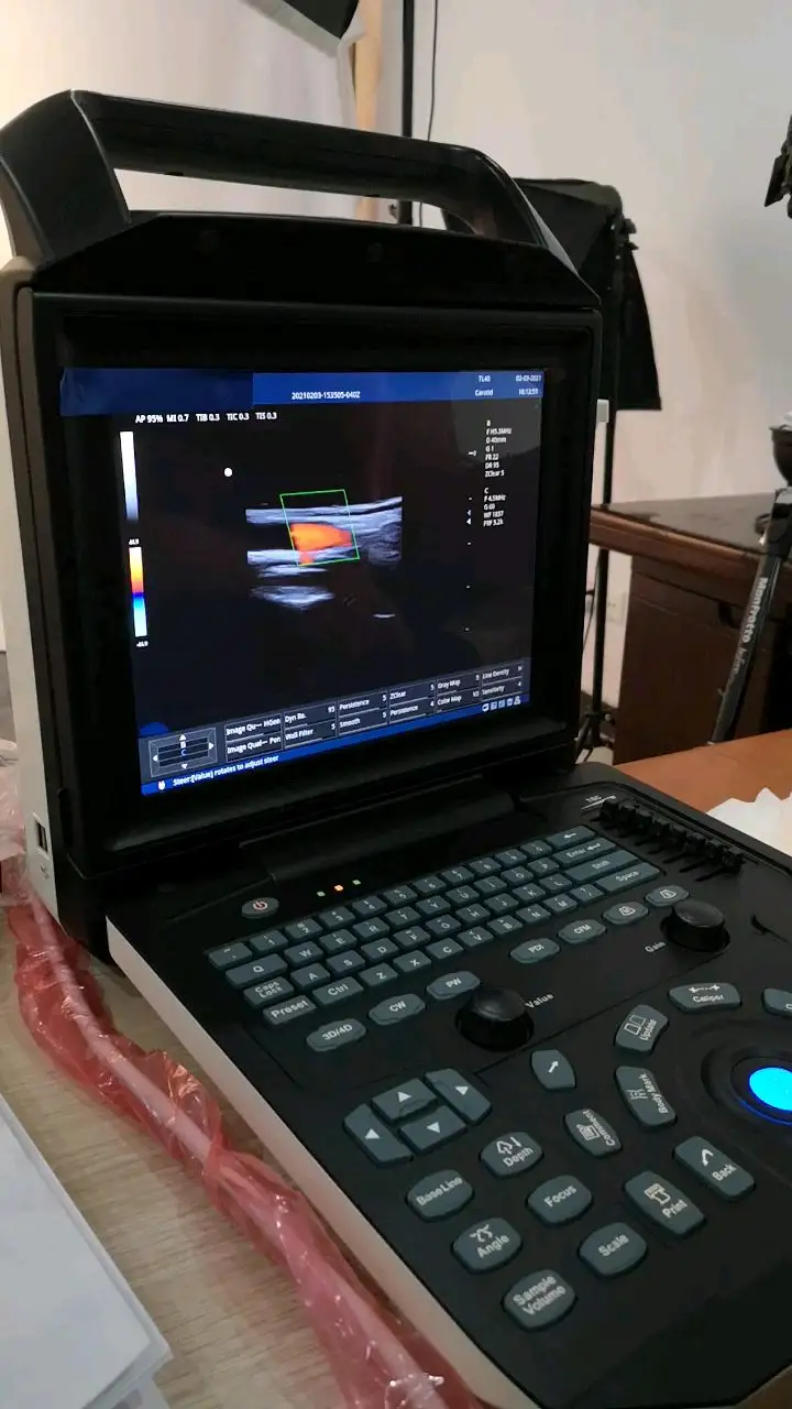 Medsinglong 의료 12.1 인치 LED 화면 휴대용 컬러 도플러 시스템 수의사를위한 초음파 기계