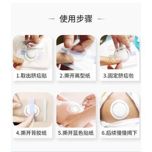 Parche para Hernia Umbilical Huawei para Bebés, Película WPU Impermeable y Transpirable para Recién Nacidos - Product Image 3