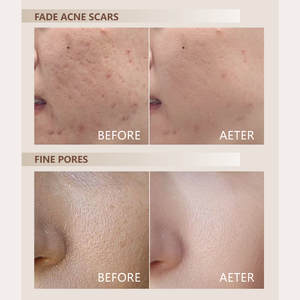 OEM Natürliches Spongilla-Peeling-Pulver Nicht-Invasives Spongilla-Spiculae-Peeling zur Narbenreduzierung Professioneller Kollagen-Booster Gesichtspeeling - Product Image 6