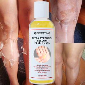 Etiqueta privada Orgánico Vegano Cuidado del cuerpo Nudillos Blanqueamiento DE LA PIEL Exfoliante Nutritivo Hidratante Piel Amarillo Peeling Oil - Product Image 1