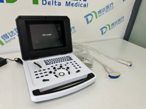 Escáner de Ultrasonido Blanco y Negro de Alta Calidad para Hospital, Sistema de Diagnóstico Veterinario, Máquina de Ultrasonido Portátil para Humanos - Product Image 2