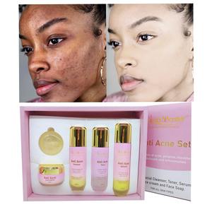 El mejor conjunto de cuidado de la piel antiacné Facial, eliminación de espinillas, fuerte y eficaz, conjunto de blanqueamiento Facial antiacné, suero antiacné, crema facial - Product Image 2