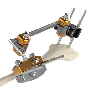 CANWELL Hoffman Externe Fixatie Instrumentenset Staaf Staaf 11mm Compact Systeem Orthopedisch Klasse III Levenslange Garantie Model Geschikt voor - Product Image 2