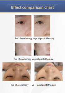 High Quality Hydra Beauty Facial <b>Machine</b> 11 1 Oxygen Hydro Dermabrasion with <b>Microcurrent</b> Technology Multifunctional Facial Care - Product Image 5