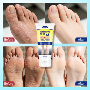 Crème hydratante et baume pour les pieds à <span class=keywords><strong>base</strong></span> <span class=keywords><strong>d</strong></span>'urée, hydratation intensive pour les pieds et talons secs et rugueux, vente en gros - Product Image 2