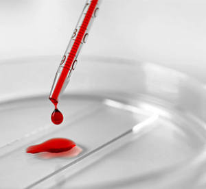 HAIJU จานแก้ว Petri 60-150มม. สำหรับใช้ในห้องปฏิบัติการ - Product Image 4