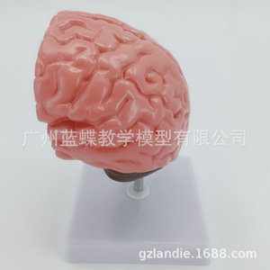 Anatomía del cerebro humano; modelo de cerebro/ictus; modelo de enfermedad cerebral; hemorragia cerebral; modelo anatómico de lesiones cerebrales. - Product Image 1