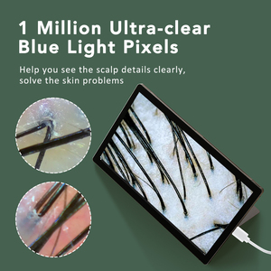 多機能ビジュアルポアテストデバイスポータブルHDスカルプスキャナー検出器毛包スキンアナライザーカメラ付き - Product Image 3