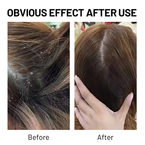 <span class=keywords><strong>แชมพู</strong></span>ขจัดรังแค1% น้ำมันมะพร้าวสังกะสี pyrithione ผสมเพื่อให้ความชุ่มชื้นแห้งและบรรเทาอาการคันฉลากส่วนตัว - Product Image 5