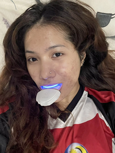 Kit de Blanqueamiento Dental con Luz LED Azul y Roja, Sin Calor, Sin Sensibilidad, Seguro para el Esmalte, para Spa y <span class=keywords><strong>Centro</strong></span> de Belleza - Product Image 5