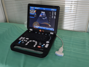 Nuevo Ecógrafo Doppler 3D Portátil Médico 2026, Mejor <span class=keywords><strong>Precio</strong></span>, Máquina de Ultrasonido 3D 4D - Product Image 3