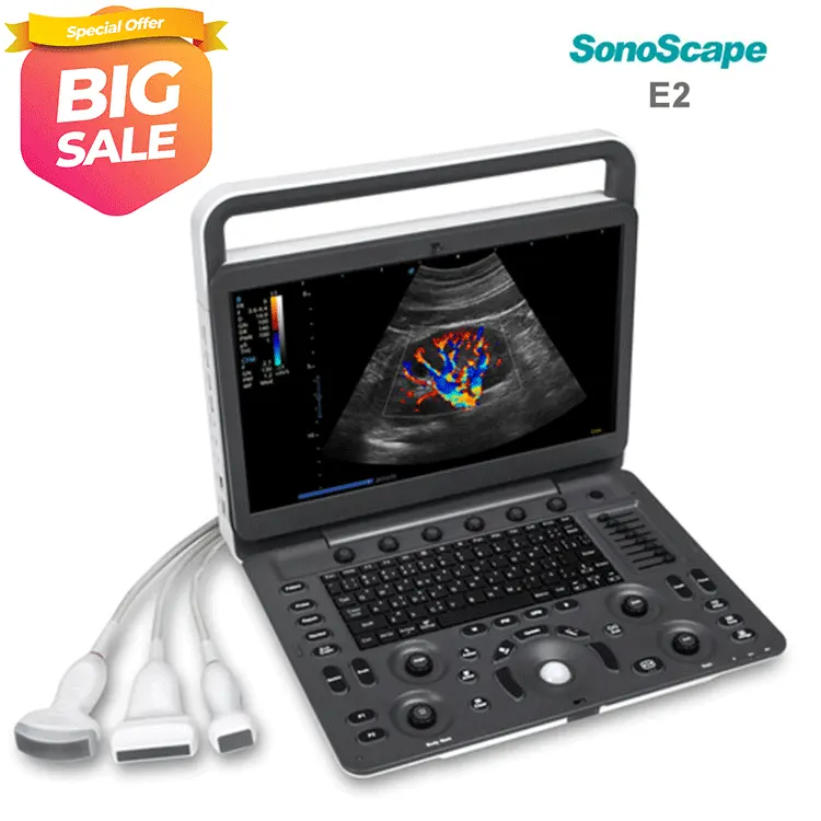 Sonosape E2V E2 pemindai hewan portabel, mesin Ultrasound Doppler warna