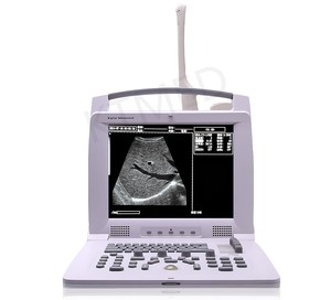 KT-A012 Portable Digital VET/human B/W Ultrasound Laptop Type Black and White Ultrasound Scanner Machine for <strong>Pregnancy</strong> - Product Image 1