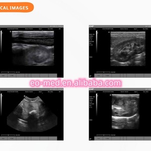 Appareil d'échographie chinois BW21B, scanner d'échographie vétérinaire portable noir et blanc - Product Image 6