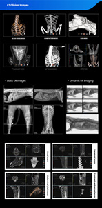 Apparecchiatura Veterinaria Multifunzione All-in-One: Scanner Digitale DR CT Panoramico Dentale a Raggi X per Animali Domestici di Grandi Razze (Cani, Gatti) - Product Image 5