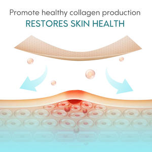 Elaimei Silicon Repair Damage Scar Sheet Gel Venta caliente Eliminación <span class=keywords><strong>de</strong></span> <span class=keywords><strong>cicatrices</strong></span> y marcas Acné Productos <span class=keywords><strong>de</strong></span> eliminación <span class=keywords><strong>de</strong></span> <span class=keywords><strong>cicatrices</strong></span> antiguas - Product Image 5