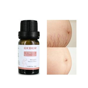 Özel Logo cilt bakımı onarım tedavisi streç işaretleri özel etiket Oem doğal streç işaretleri kaldırma yağı - Product Image 2