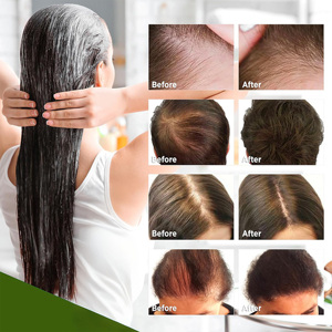 Champú Herbal de Romero Natural OEM Personalizado, Fórmula Antiencrespamiento, Control de Grasa, Crecimiento del Cabello, Nutrición del Cuero Cabelludo Seco - Product Image 6
