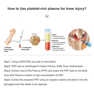 หลอด PRP สำหรับเก็บเลือดเพื่อทำพลาสมาที่อุดมด้วยเกล็ดเลือด พร้อมเจลโซเดียมซิเตรต 10 มล. จากโรงงานผู้ผลิตโดยตรง (OEM) - Product Image 2