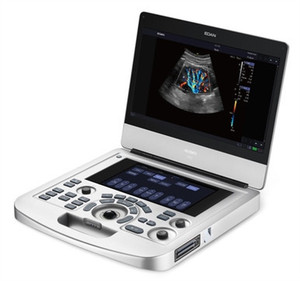 Máquina de Ultrasonido Veterinaria Portátil Edan DUS 60 con Batería Integrada y Certificación CE para Diagnóstico Animal - Product Image 5