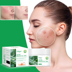 Crema Hidratante de <span class=keywords><strong>Aloe</strong></span> <span class=keywords><strong>Vera</strong></span> Natural Zaleyae, Desvanece Manchas, Antiacné, Reduce Poros, Nutre, Repara, Rejuvenece, Gel para el Cuidado Facial - Product Image 4