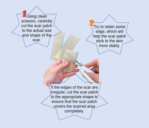 מקצועי דבק סיליקון טיפול צלקת קרש לנשימה וגמיש - Product Image 4