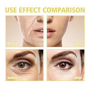 Vente chaude Serpent Huile Sérum Tache Sombre Éclaircissant Raffermissant Lissant Essence Ridules Hydratation Anti-âge Solution De Soins De La Peau - Product Image 4