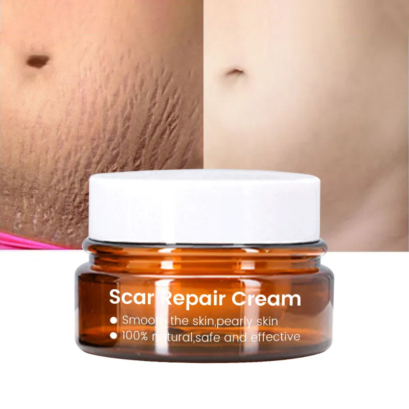 Crema orgánica para cicatrices faciales y piernas, espinillas, estrías, elimina las marcas, crema fuerte y eficaz para eliminar las cicatrices del acné, 20g