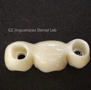Puente de Zirconia para dentaduras postizas de implante adecuado para la mayoría de los postes de escaneo del sistema de implante se pueden proporcionar <span class=keywords><strong>Freey</strong></span> - Product Image 5