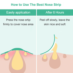 แผ่นแปะจมูกไฮโดรคลอลิกสำหรับรูขุมขนบนจมูกสิวสิวสิวและน้ำมันซึมซับสิวบนจมูก - Product Image 3
