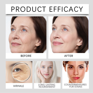 Suero Facial <span class=keywords><strong>de</strong></span> Aceite <span class=keywords><strong>de</strong></span> Semilla Negra Natural y Orgánico para el Cuidado <span class=keywords><strong>de</strong></span> la Piel, Reparador, Potenciador <span class=keywords><strong>de</strong></span> la Belleza, Hidratante, Antiarrugas, Reafirmante y Blanqueador - Product Image 3