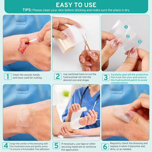 แผ่นปิดแผลไฮโดรคอลลอยด์ทางการแพทย์สำหรับรักษาสิว ซิลิโคนใสแบบม้วน ป้องกันผิว ตัดแต่งได้ แผ่นปิดแผลเทียม - Product Image 5