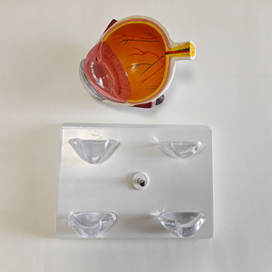 Modelo Anatómico Patológico del Ojo Humano, Modelo de Exhibición de Enfermedades de la Córnea para Enseñanza Médica - Product Image 4