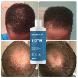 迷迭香薄荷强化洗发水注入生物素，清洁并有助于强化脆弱的头发 - Product Image 6