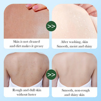 Gel Douche Exfoliant Éclaircissant et Hydratant OEM en Gros, 24 Parfums, à la Niacinamide, pour Blanchir la Peau et la Rafraîchir