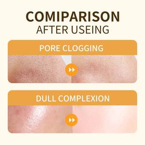 Espuma Limpiadora Profunda con Vitamina C de Marca Privada OEM, Limpiador Facial Suave e Iluminador para Piel Grasa, Control de Grasa con Glicerina, Marca Privada - Product Image 6