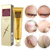 Gel-Crème Traitement Réparateur de Peau pour Cicatrices d'Acné, Vergetures et de Césarienne, Ointment Narbenentfernungsgel