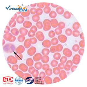 현미경 준비 슬라이드 18pcs 혈액학 준비 슬라이드 혈액 도말 준비 슬라이드 - Product Image 3