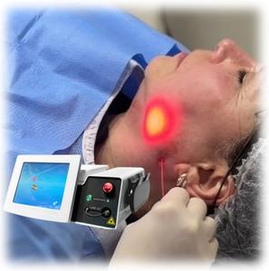 Endoláser ojos alrededor del diodo 1470 cuello elevación <span class=keywords><strong>de</strong></span> la <span class=keywords><strong>papada</strong></span> láser Endo Diodo láser lipólisis Lazer Fiberlift 1470 máquina <span class=keywords><strong>de</strong></span> elevación <span class=keywords><strong>de</strong></span> endoláser - Product Image 2