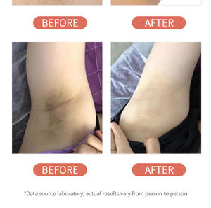 <span class=keywords><strong>Déodorant</strong></span> Roll-On Naturel Biologique Minéral Longue Durée Hydratant Blanchissant Éclaircissant Éliminant les Taches Sombres sous les Aisselles Parfum - Product Image 6