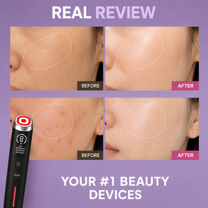Appareil de beauté professionnel Glass Skin Age Booster Pro, appareil de soin par électroporation EP, appareil facial <span class=keywords><strong>anti</strong></span>-âge, équipement de beauté, marque privée - Product Image 6