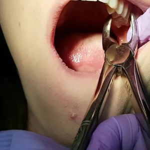 Pinzas de Extracción Dental de Acero Inoxidable de Alta Calidad, Fabricadas en Fábrica, Patrón Inglés de Primera Clase, Resistentes a la Oxidación, Marca Privada - Product Image 5