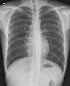 Detektor Panel Datar Digital Nirkabel 17x17 untuk Pemeriksaan Fisik Manusia, Penggunaan Veteriner, Radiologi, dan Penggunaan Darurat - Product Image 5