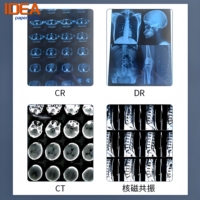 Película Médica Blanca de Alta Resolución para Impresoras de Inyección de Tinta, Base PET, Compatible con DICOM, para Ultrasonido y Endoscopia, Directo de Fábrica