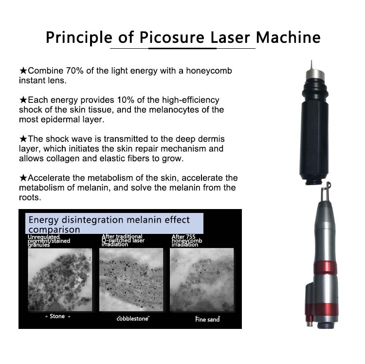 Professional Picosecond Laser Machine Picolaser pigmentation Treatment Freckle Removal 755nm Pico Laser Machine on Sale
