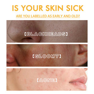 Crème de massage au collagène - Blanchit la peau, éclaircit le teint, réduit les taches brunes, nettoie les pores, exfolie 100g - Product Image 5